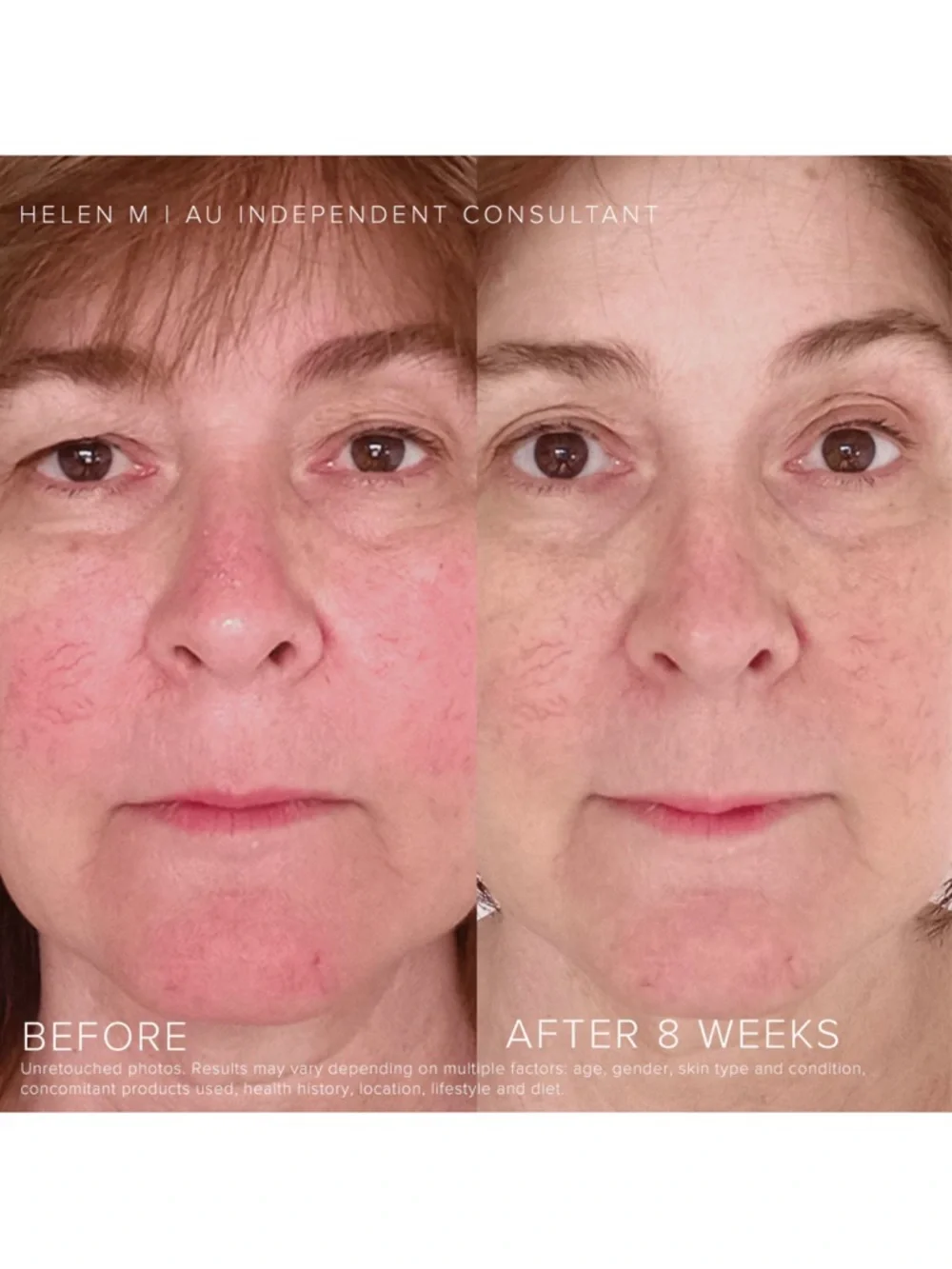 Rodan + Fields rodan fields